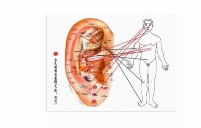 穴位减肥有用吗,减肥竟然还能这么做 减肥 第6张-瘦瘦减肥网 穴位减肥有用吗,减肥竟然还能这么做 减肥 第6张