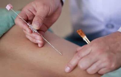 穴位减肥有用吗,减肥竟然还能这么做 减肥 第3张-瘦瘦减肥网 穴位减肥有用吗,减肥竟然还能这么做 减肥 第3张