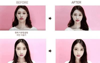 韩国瘦脸贴有用吗，瘦脸贴是否可以用双眼皮贴替代 瘦脸 第1张