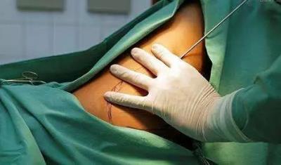 女生减肥误区,公认的6大最无知减肥方法 减肥误区 第3张-瘦瘦减肥网 女生减肥误区,公认的6大最无知减肥方法 减肥误区 第3张