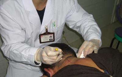 埋线减肥法的两大禁忌,谨记禁忌方能安全甩肉 减肥方法 第8张-瘦瘦减肥网 埋线减肥法的两大禁忌,谨记禁忌方能安全甩肉 减肥方法 第8张