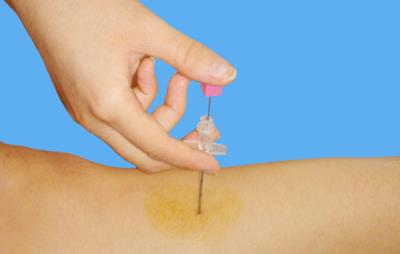 埋线减肥法的两大禁忌,谨记禁忌方能安全甩肉 减肥方法 第4张-瘦瘦减肥网 埋线减肥法的两大禁忌,谨记禁忌方能安全甩肉 减肥方法 第4张