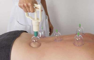 拔罐减肥会影响月经吗,非经期适度拔罐不会影响月经 拔罐减肥 第2张-瘦瘦减肥网 拔罐减肥会影响月经吗,非经期适度拔罐不会影响月经 拔罐减肥 第2张