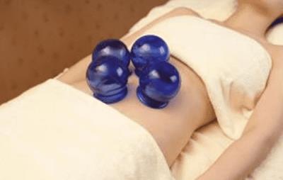 拔罐减肥会影响月经吗,非经期适度拔罐不会影响月经 拔罐减肥 第1张-瘦瘦减肥网 拔罐减肥会影响月经吗,非经期适度拔罐不会影响月经 拔罐减肥 第1张