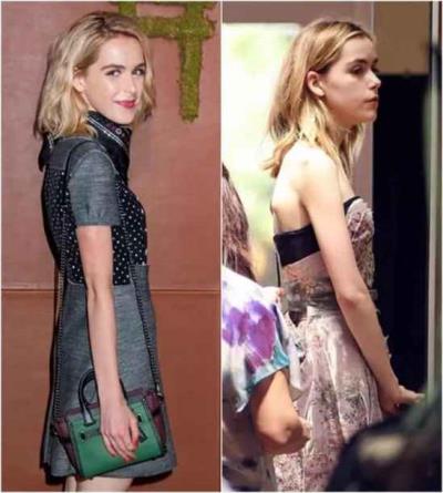 圆肩驼背怎么矫正 减肥 第2张-瘦瘦减肥网 圆肩驼背怎么矫正 减肥 第2张