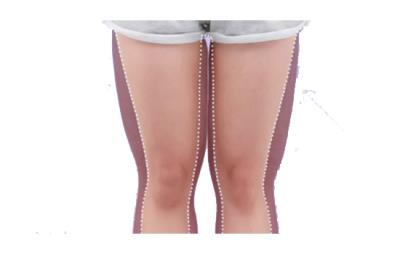 大象腿怎么减，轻松几招逆袭成闪电 瘦腿 第1张