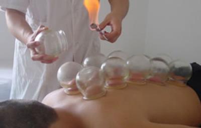 针灸减肥和拔罐减肥哪个好,关键看自身适合哪种减肥方式 针灸减肥 第7张-瘦瘦减肥网 针灸减肥和拔罐减肥哪个好,关键看自身适合哪种减肥方式 针灸减肥 第7张