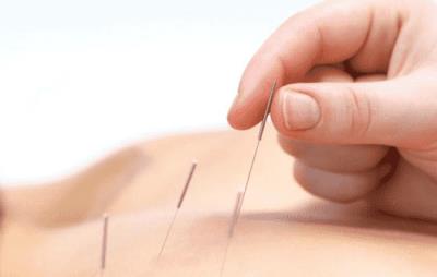 针灸减肥对身体有害吗,减少伤害选择正规医疗机构 针灸减肥 第1张-瘦瘦减肥网 针灸减肥对身体有害吗,减少伤害选择正规医疗机构 针灸减肥 第1张