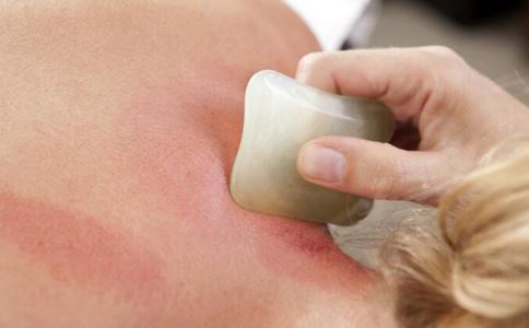 刮痧的好处(刮痧的十大好处) 刮痧减肥 第1张