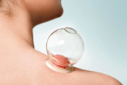 拔火罐拔出水泡怎么办(拔火罐拔出很多水泡是什么原因) 拔罐减肥 第1张-瘦瘦减肥网 拔火罐拔出水泡怎么办(拔火罐拔出很多水泡是什么原因) 拔罐减肥 第1张