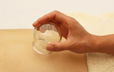 拔罐减肥有效吗,期间吃什么最佳 拔罐减肥 第5张-瘦瘦减肥网 拔罐减肥有效吗,期间吃什么最佳 拔罐减肥 第5张