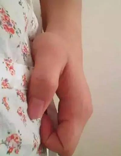 每天拍打肚子可以减腹部吗,但切忌过于用力拍 减肚子 第3张-瘦瘦减肥网 每天拍打肚子可以减腹部吗,但切忌过于用力拍 减肚子 第3张