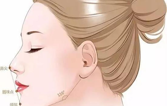 三招告别双下巴(双下巴怎么整形) 瘦脸 第1张-瘦瘦减肥网 三招告别双下巴(双下巴怎么整形) 瘦脸 第1张