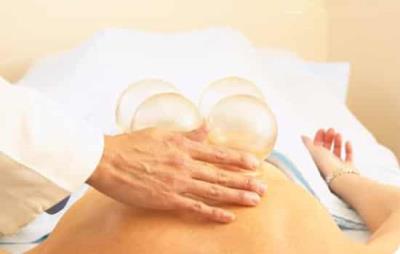 拔罐减肥有副作用吗,操作不当后果糟糕 拔罐减肥 第4张-瘦瘦减肥网 拔罐减肥有副作用吗,操作不当后果糟糕 拔罐减肥 第4张