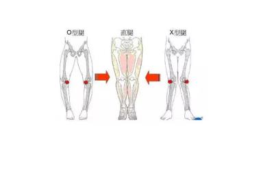 大腿粗的原因,教你针对性改善不同腿型 瘦腿 第1张-瘦瘦减肥网 大腿粗的原因,教你针对性改善不同腿型 瘦腿 第1张