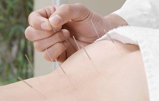 针灸减肥效果(全身针灸减肥有用吗) 针灸减肥 第1张-瘦瘦减肥网 针灸减肥效果(全身针灸减肥有用吗) 针灸减肥 第1张