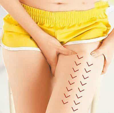 快速瘦腹的方法,按摩腹部穴位有效减肥 按摩减肥 第6张-瘦瘦减肥网 快速瘦腹的方法,按摩腹部穴位有效减肥 按摩减肥 第6张