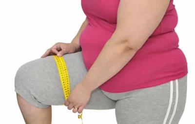 抽脂前注意事项，抽脂前这些问题需弄清 抽脂减肥 第2张