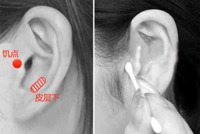 穴位按摩减肥有效吗,中医减肥方法消除水肿型肥胖 按摩减肥 第1张-瘦瘦减肥网 穴位按摩减肥有效吗,中医减肥方法消除水肿型肥胖 按摩减肥 第1张