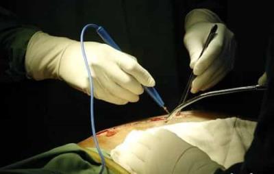 抽脂后多久能恢复，抽脂后运动需谨慎 抽脂减肥 第3张