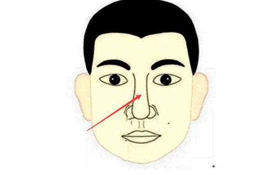 怎样快速去除双下巴(如何去除双下巴和颈纹) 瘦脸 第2张-瘦瘦减肥网 怎样快速去除双下巴(如何去除双下巴和颈纹) 瘦脸 第2张