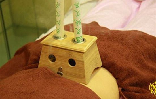 中医拔罐减肥的原理(拔罐减肥的原理) 拔罐减肥 第1张-瘦瘦减肥网 中医拔罐减肥的原理(拔罐减肥的原理) 拔罐减肥 第1张