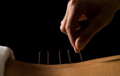 埋线减肥的危害，健康减肥才是正道 减肥 第3张