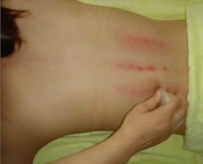 如何刮痧减肥瘦身瘦腹部,简单四招教你塑身甩脂 刮痧减肥 第4张-瘦瘦减肥网 如何刮痧减肥瘦身瘦腹部,简单四招教你塑身甩脂 刮痧减肥 第4张