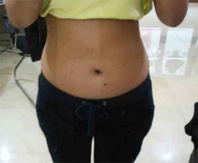 春季如何简单有效的健康减肥,1个月减20斤的方法 减肥 第1张-瘦瘦减肥网 春季如何简单有效的健康减肥,1个月减20斤的方法 减肥 第1张