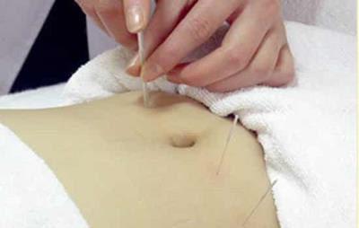 针灸埋线减肥有效吗，教你如何更有效减肥 针灸减肥 第2张