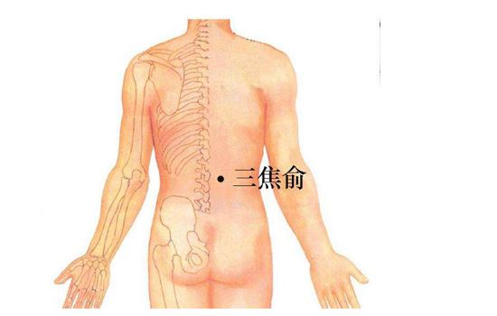 拔罐减肥的位置图，3个部位穴位拔罐瘦身 拔罐减肥 第1张
