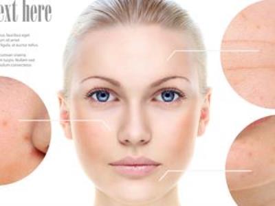 面部吸脂10个知识 谨慎应对 安心瘦脸 瘦脸 第1张