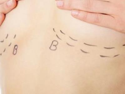 胸部下垂的原因 如何让胸部挺拔 减肥 第1张