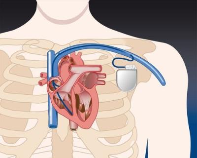 青少年吃糖太多的危害 饮食减肥 第2张-瘦瘦减肥网 青少年吃糖太多的危害 饮食减肥 第2张