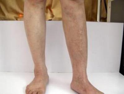 腿粗腿弯还是肉多 2组腿部训练瘦腿一步到位 瘦腿 第1张-瘦瘦减肥网 腿粗腿弯还是肉多 2组腿部训练瘦腿一步到位 瘦腿 第1张