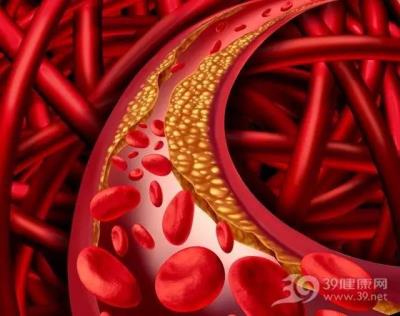 油脂血 你了解了之后你还敢乱吃吗 饮食减肥 第1张-瘦瘦减肥网 油脂血 你了解了之后你还敢乱吃吗 饮食减肥 第1张