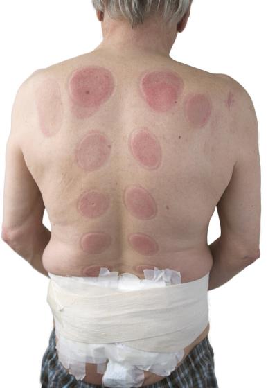 医学减肥有什么方法呢? 减肥 第2张-瘦瘦减肥网 医学减肥有什么方法呢? 减肥 第2张