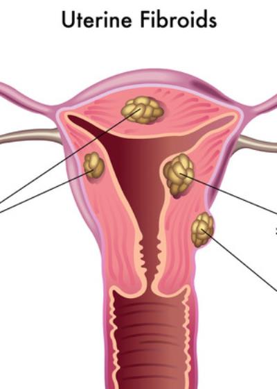 瘦身小运动 没事就练练 运动减肥 第1张