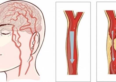 日本少女赢美腿大赛 瘦腿秘籍公开 瘦腿 第2张-瘦瘦减肥网 日本少女赢美腿大赛 瘦腿秘籍公开 瘦腿 第2张