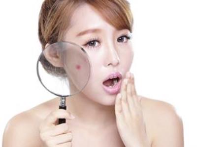 减肥长痘痘？养成这些好习惯助你摆脱痘痘的苦恼 减肥 第1张