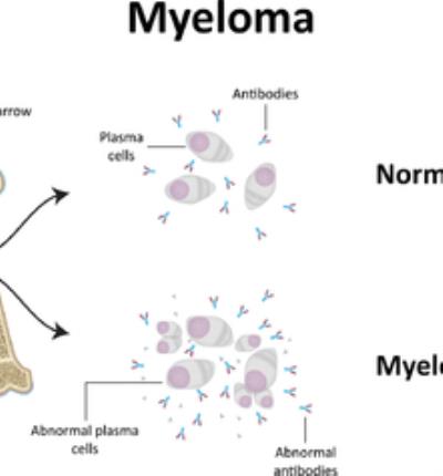 如何练出锁骨？运动+按摩打造性感锁骨 按摩减肥 第3张
