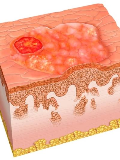 可乐、星冰乐等热门零食谁是致胖真凶 减肥 第3张